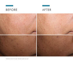 Discoloration Defense Serum