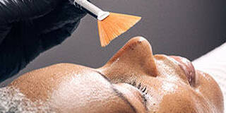 Peeling Chimique Moyenne
