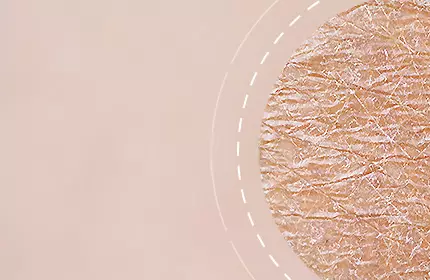 Close-up of textured skin with visible fine lines and a soft, neutral background.