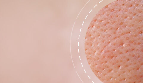 Close-up of textured skin, highlighting pores and surface details against a soft, blurred background.