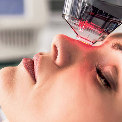 non ablative laser