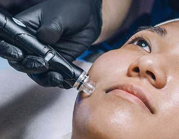 Un gros plan d'un visage recevant un traitement cutane avec un appareil, tandis qu'une main portant des gants noirs tient l'appareil.