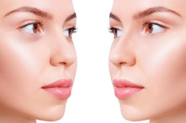 Deux profils d'un visage feminin avec une peau lisse et une expression neutre.