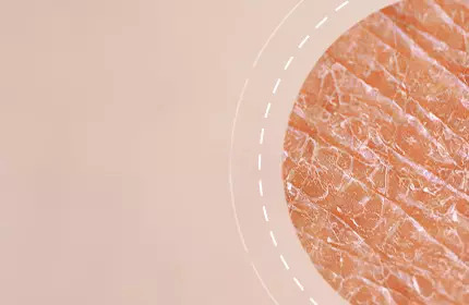 Close-up view of textured skin, with a soft, light background and a circular inset highlighting the skin's surface details.