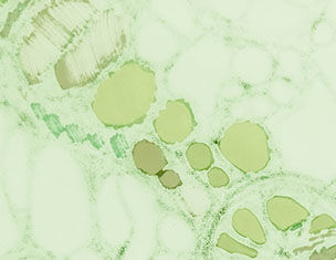 Une image au microscope montrant des cellules vertes avec differentes tailles et formes de vacuoles dans un contexte biologique.