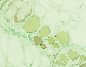 Une image au microscope montrant des cellules vertes avec differentes tailles et formes de vacuoles dans un contexte biologique.