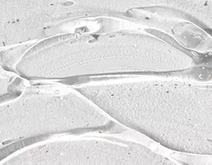 Close-up of clear gel or liquid on a textured white surface, displaying smooth contours and reflections.