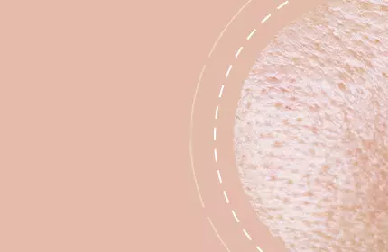 Close-up view of a textured skin surface with a soft, neutral background.