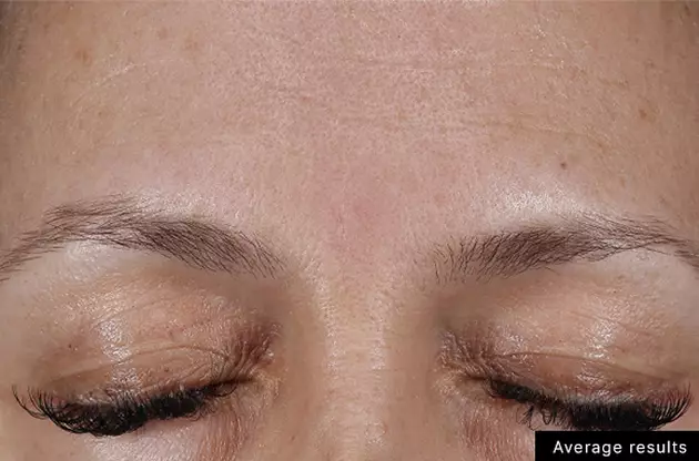 Une vue rapprochee d'un front feminin avec des sourcils fins et des cils longs, montrant une peau claire et legere.